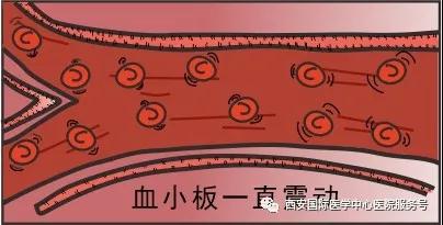 【科普】血小板是正常值的三倍？專家提醒小心血栓和出血！