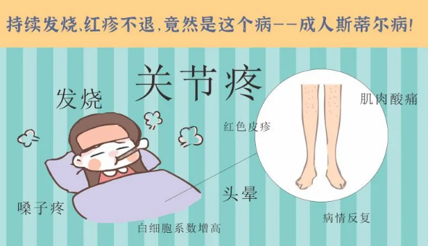 持續(xù)發(fā)燒、紅疹不退……她終于在這里治好了這個(gè)罕見(jiàn)病