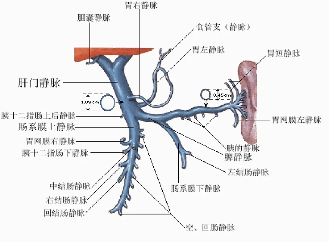 反復(fù)嘔血、黑便怎么辦？TIPS手術(shù)能解決