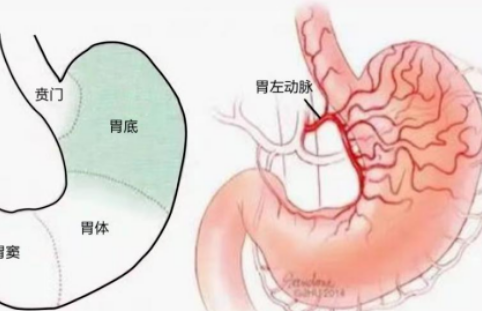 不開刀不吃藥不餓肚子，微創(chuàng)介入減肥靠譜嗎？