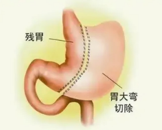 愛吃不想動，有救么？